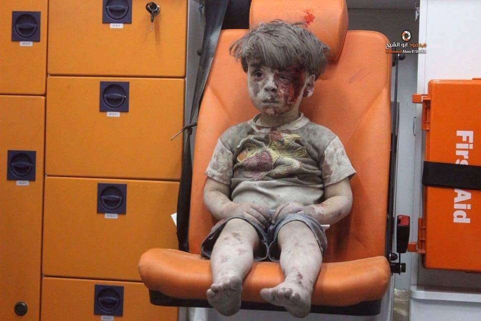 El niño herido en un bombardeo: un reflejo del infierno en Siria