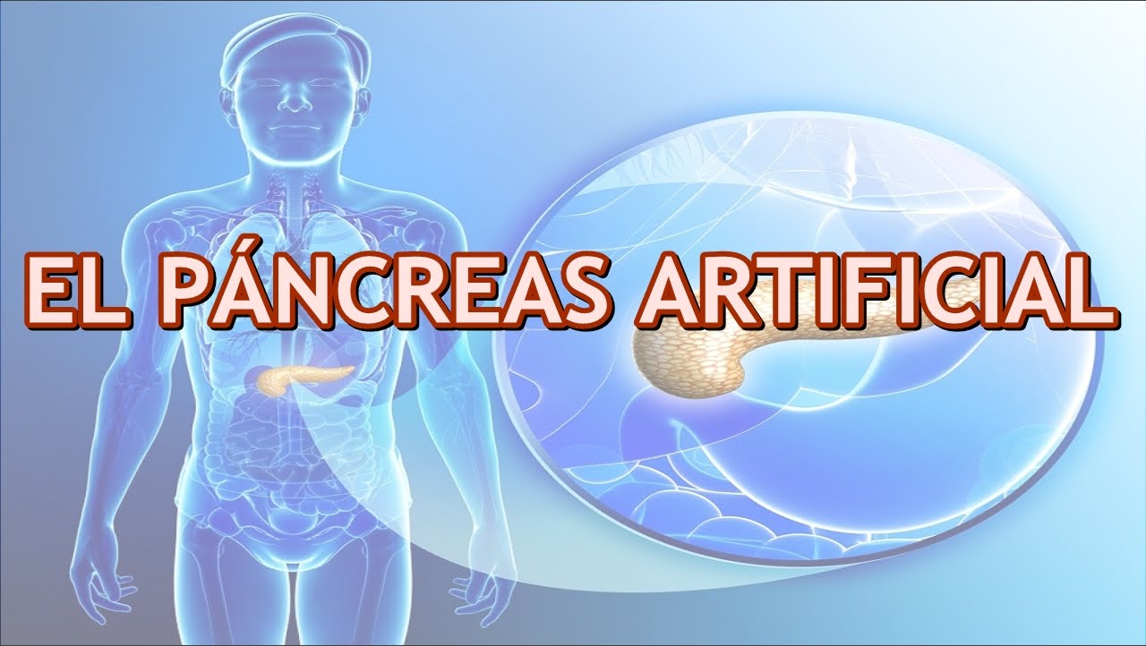 Páncreas artificial en pacientes con diabetes